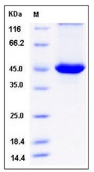 SDS-PAGE analysis of human SerpinB4 His tag protein