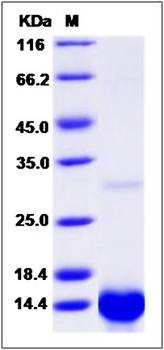 SDS-PAGE analysis of human TGFA protein (Native)