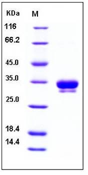 SDS-PAGE analysis of human ASAM His tag protein