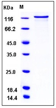 SDS-PAGE analysis of Human PRKD3 GST tag protein