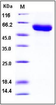 SDS-PAGE analysis of mouse GFRA1 His tag protein
