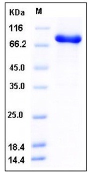 SDS-PAGE analysis of human STXBP1 His GST tag protein