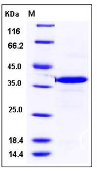 SDS-PAGE analysis of mouse CA8 His tag protein