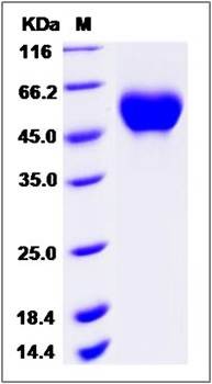 SDS-PAGE analysis of Cynomolgus IL1R1 protein (His Tag)