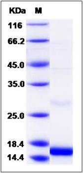 SDS-PAGE analysis of human SLPI protein (His Tag)