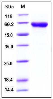 SDS-PAGE analysis of Mouse DKK3 His tag protein