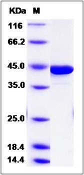 SDS-PAGE analysis of Human IVD protein (His Tag)