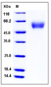 SDS-PAGE analysis of Human SerpinA6 His tag protein