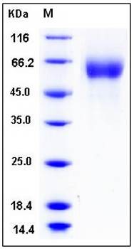 SDS-PAGE analysis of human FGFR4 His tag protein