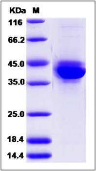 SDS-PAGE analysis of mouse S100A4 protein