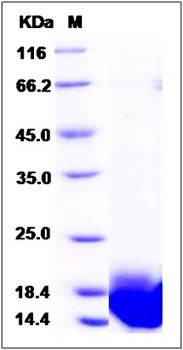 SDS-PAGE analysis of Human LSM3 protein (His Tag)