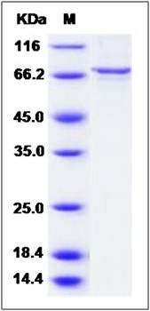 SDS-PAGE analysis of human Arginosuccinase protein (GST Tag)