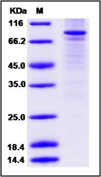 SDS-PAGE analysis of Human PPARG protein (GST Tag)