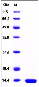 SDS-PAGE analysis of Human LAMTOR2 His tag protein