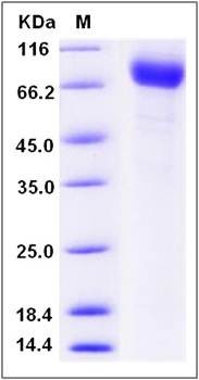 SDS-PAGE analysis of human ANTXR1 protein