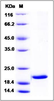 SDS-PAGE analysis of human SRI protein