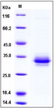 SDS-PAGE analysis of human FOLR2 His tag protein