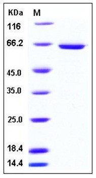 SDS-PAGE analysis of human SMPD1 His tag protein