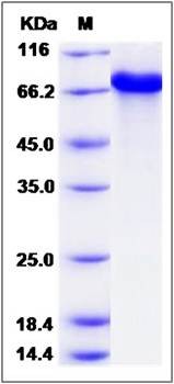 SDS-PAGE analysis of human CPNE1 protein (N-SUMO Tag)