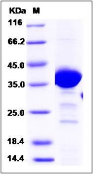 SDS-PAGE analysis of Human NAPG protein (His Tag)