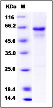 SDS-PAGE analysis of human ERN1 protein