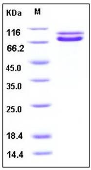 SDS-PAGE analysis of human CDH2 His tag protein