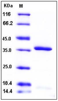 SDS-PAGE analysis of Human HTRA2 His tag protein