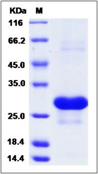 SDS-PAGE analysis of Interferon alpha-B (His Tag) protein