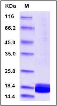 SDS-PAGE analysis of Human IL1F5 protein (Native)