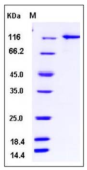 SDS-PAGE analysis of Human UBA1 protein (GST Tag)