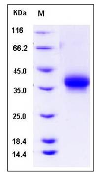 SDS-PAGE analysis of Human PROCR protein (His Tag)