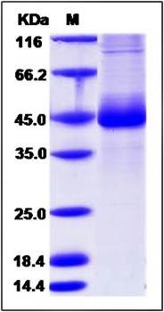 SDS-PAGE analysis of Canine IL3Ra protein (His Tag)