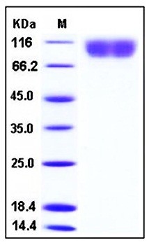 SDS-PAGE analysis of Human PDGFRB His tag protein
