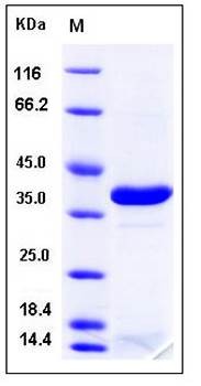 SDS-PAGE analysis of human APE His tag protein