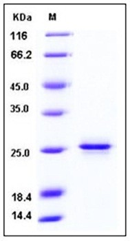 SDS-PAGE analysis of Human PRDM2 protein