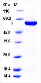 SDS-PAGE analysis of human GALK1 His GST tag protein