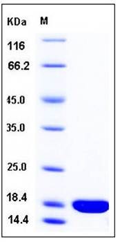 SDS-PAGE analysis of Human IL1F8 protein (Native)