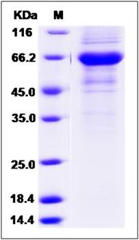 SDS-PAGE analysis of human FAIM3 protein