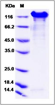 SDS-PAGE analysis of human CDH1 protein