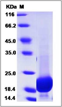 SDS-PAGE analysis of GMFG gamma (His Tag) protein