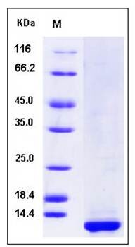 SDS-PAGE analysis of human CLPS protein (His Tag)