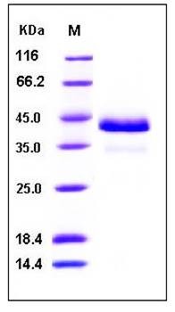 SDS-PAGE analysis of human CTSB His tag protein