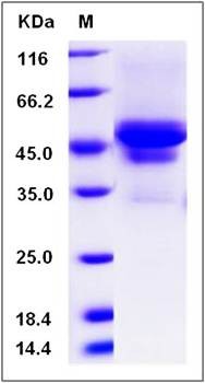 SDS-PAGE analysis of canine CA9 protein (His Tag)