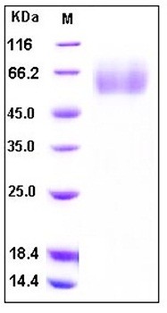SDS-PAGE analysis of human SRA His tag protein