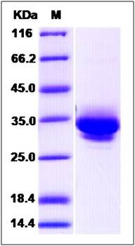 SDS-PAGE analysis of Human JAM-C protein