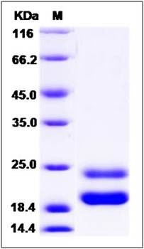 SDS-PAGE analysis of rat GM-CSF protein (His Tag)