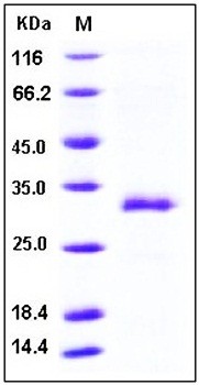 SDS-PAGE analysis of Mouse MBL1 His tag protein