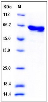 SDS-PAGE analysis of Human MAPK13 His tag protein