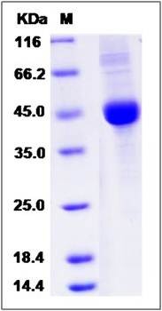 SDS-PAGE analysis of human BTC protein