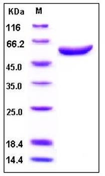 SDS-PAGE analysis of human ARSA His tag protein